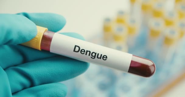 Primo piano scienziato mani guanti laboratorio prova di protezione della provetta Dengue sfondo positivo — Video Stock