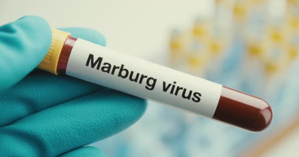 Close-up cientista mãos luvas laboratório tubo de teste de proteção Marburg vírus fundo positivo — Vídeo de Stock