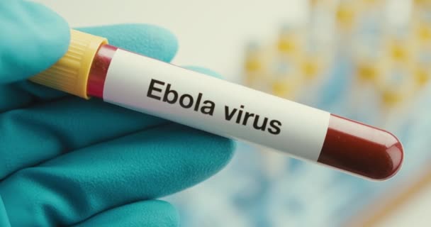 Close-up επιστήμονας χέρια γάντια εργαστηριακό σωλήνα δοκιμής προστασία του ιού Έμπολα θετικό υπόβαθρο — Αρχείο Βίντεο