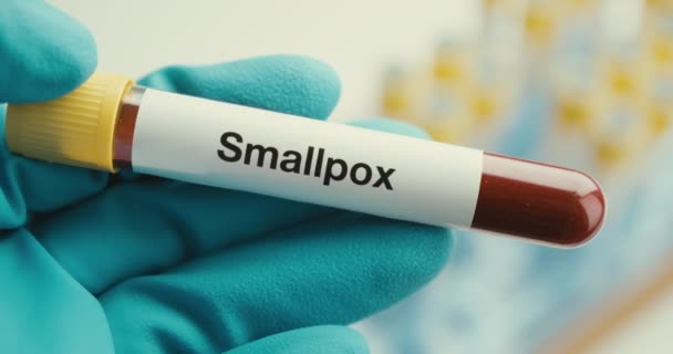 Close-up cientista mãos luvas laboratório tubo de teste de proteção Smallpox fundo positivo — Vídeo de Stock