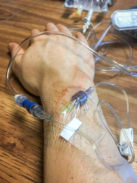 Infusie of Iv injectie — Stockfoto