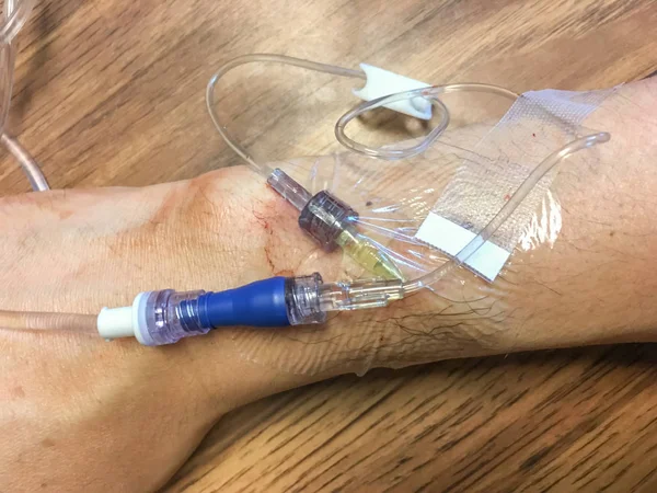 Infusie of Iv injectie — Stockfoto