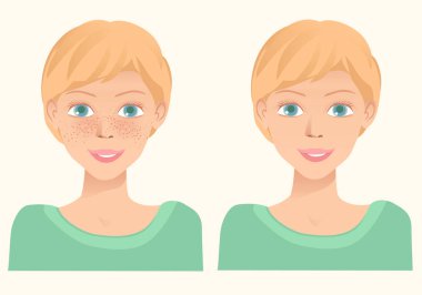 Cheerful cute young girl with freckles and same girl  without fr clipart