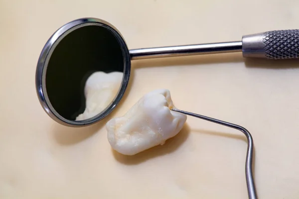 Dente Sabedoria Humana Espelho Odontológico Removendo Dentes Sabedoria — Fotografia de Stock
