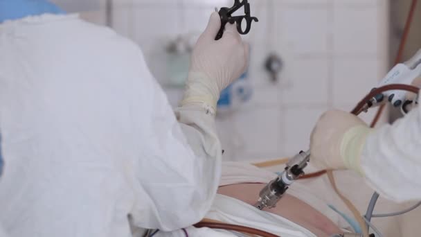 Cirurgião com assistentes faz cirurgia laparoscópica . — Vídeo de Stock