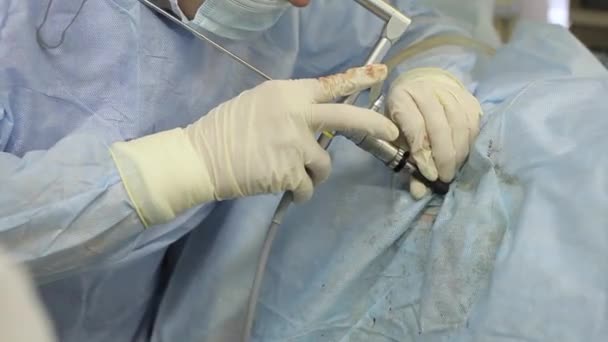 Gros plan de la main d'un chirurgien enlever les pierres du rein du patient — Video