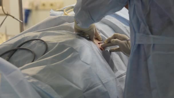 Chirurg wykonuje małe nacięcie na rozpoczęcie operacji. — Wideo stockowe