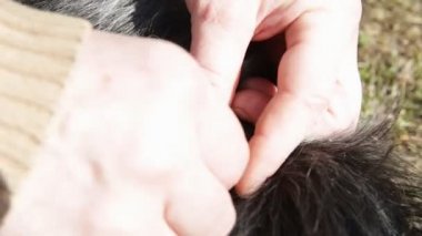 Yanlış biçimde kaldırılmış sıkışmış kene deri