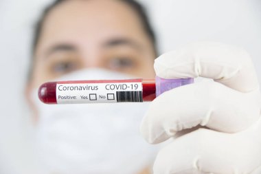 Güvenlik maskeli ve eldivenli bir kadın beyaz arka planda kanla dolu bir tüp tutuyor. Coronavirus konsepti