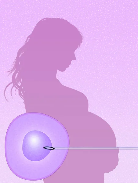 Illustration of assisted reproduction — Stock Photo, Image