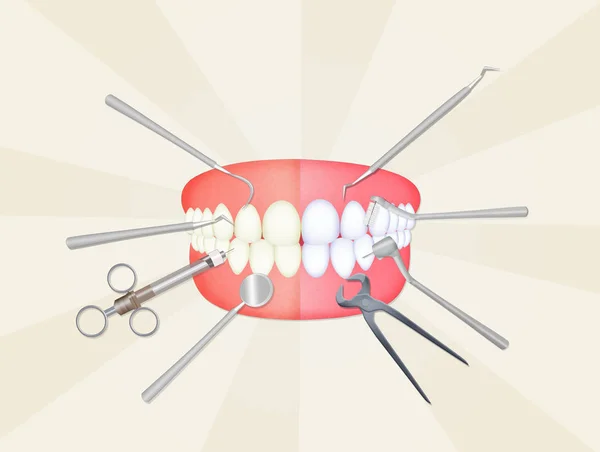 Mouth with dentist tools — Stock Photo, Image