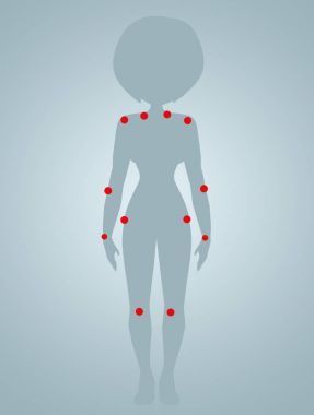 İhale noktaları fibromiyalji