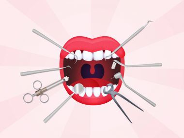 ağız diş hekimi araçları ile açık