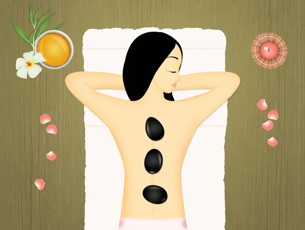 Illustration Der Rückenmassage Mit Steinen — Stockfoto