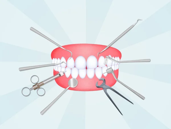 Illustration Bouche Avec Des Outils Dentistes — Photo