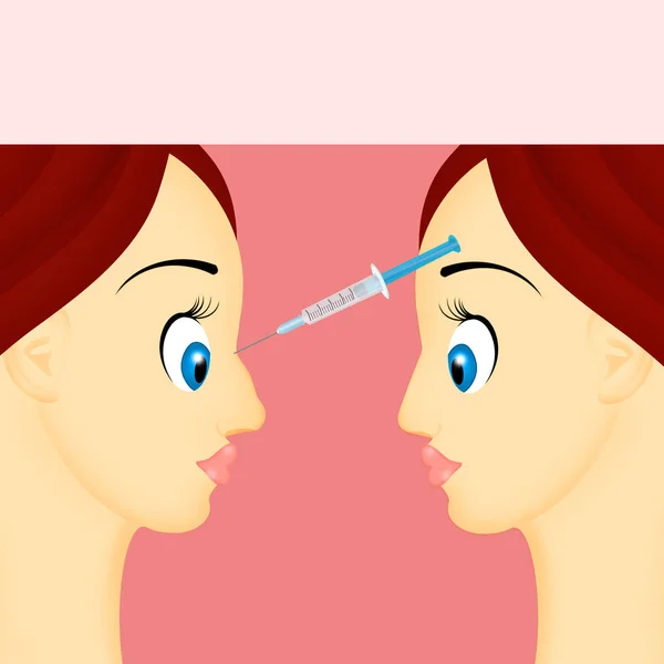 Illustration Hyaluronic Acid Injection Correct Nose — Stock Photo, Image