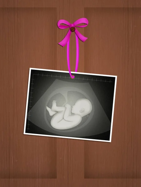 Illustration Echography Baby Female — Stock Photo, Image