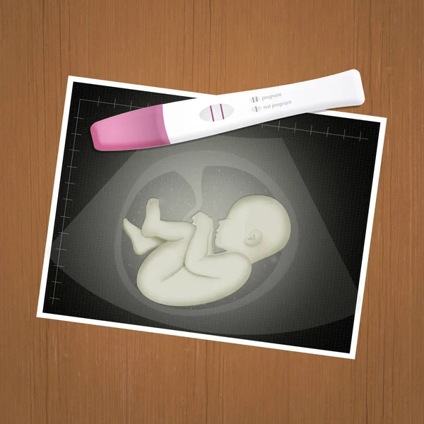 声像图和测试怀孕 — 图库照片