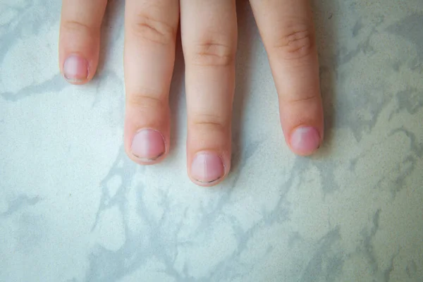 Makro foto. En femårings hand, fem fingrar. Fem år gammal barnhand med fem fingrar. Fem år gamla naglar och finger vit bakgrund . — Stockfoto