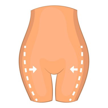 Uyluk plastik cerrahi simgesi, karikatür tarzı