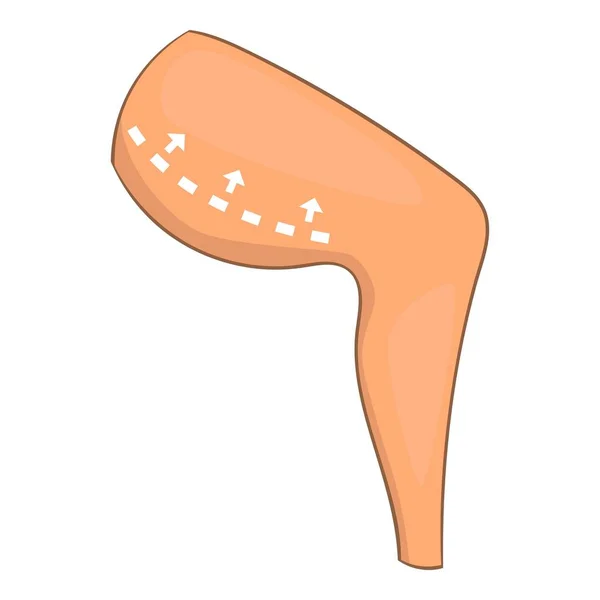 Icono de corrección de cirugía de muslo, estilo de dibujos animados — Vector de stock