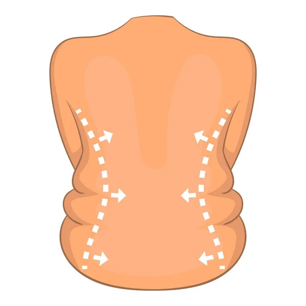 Körperseite Chirurgie Korrektur Ikone, Cartoon-Stil — Stockvektor