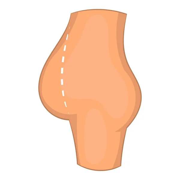 Icono de corrección de cirugía abdominal, estilo de dibujos animados — Vector de stock