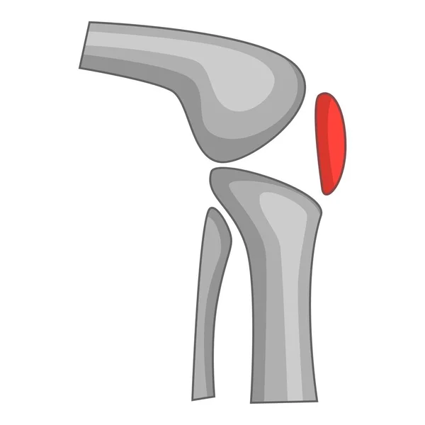 Vervanging van knie implantaat pictogram, cartoon stijl — Stockvector