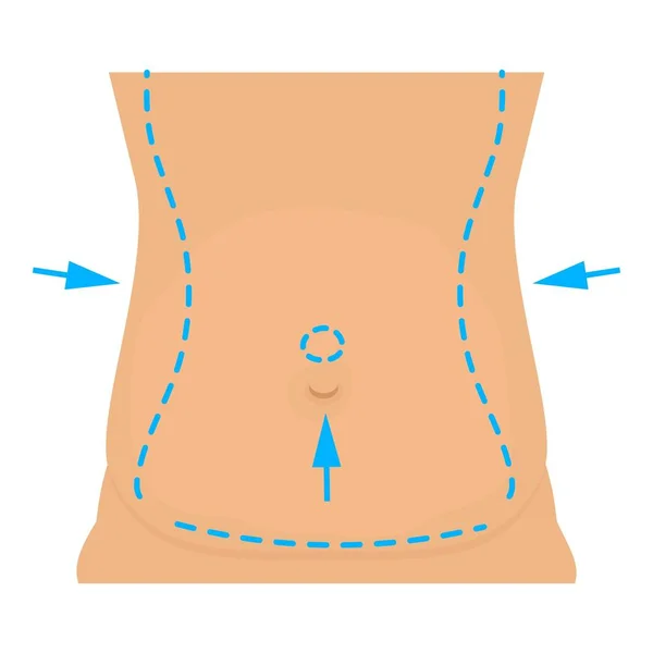 Cintura icono de corrección de plástico, estilo de dibujos animados — Vector de stock