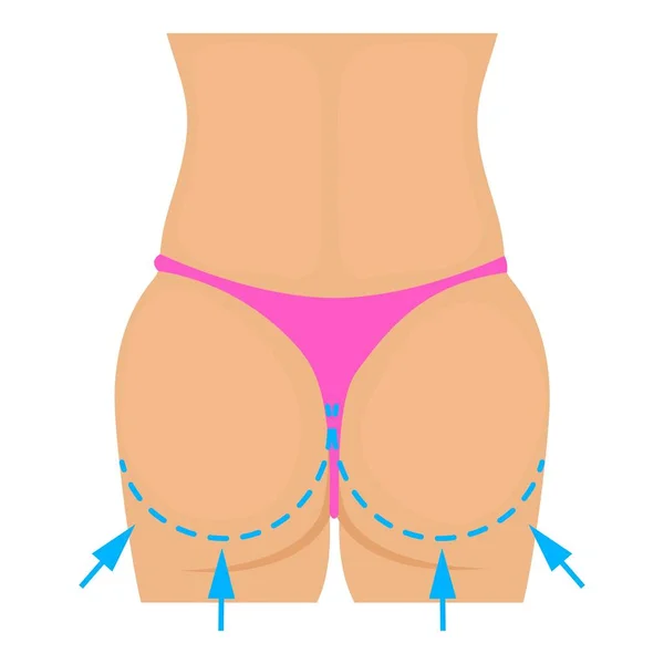 Icono de corrección de plástico en las nalgas, estilo dibujos animados — Archivo Imágenes Vectoriales