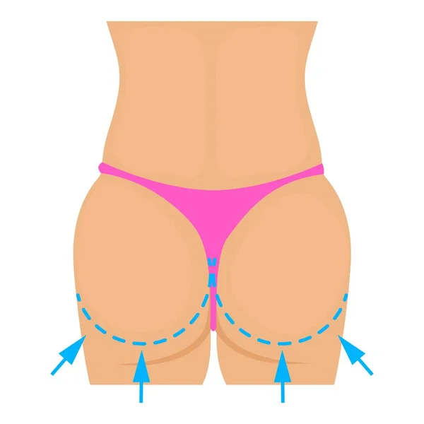 Buttocks plastic correction icon, cartoon style — Stock Vector