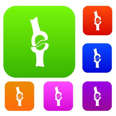 Diz eklemi renk koleksiyonu ayarla