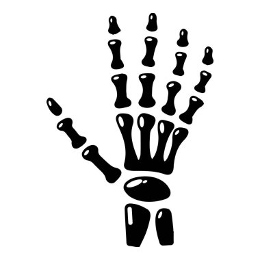 El simgesi, basit tarzı iltihabı.