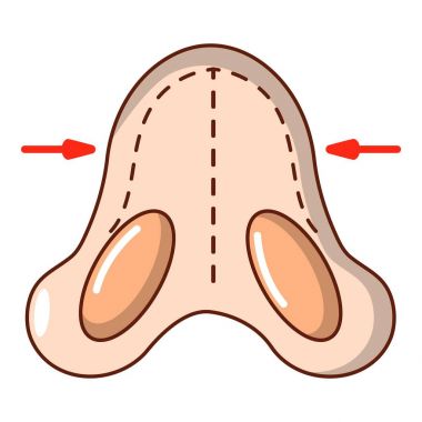 Burun küçültme simgesini, karikatür tarzı.