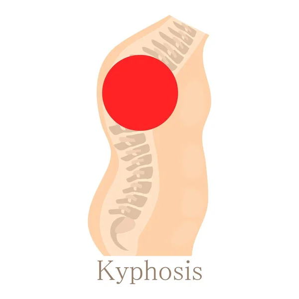 Kyphose-Ikone, Cartoon-Stil — Stockvektor