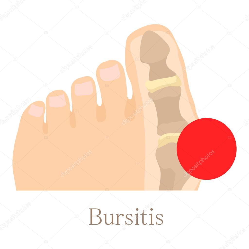 Bursitis icon, cartoon style