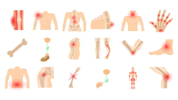 Menselijke botten pictogrammenset, cartoon stijl — Stockvector