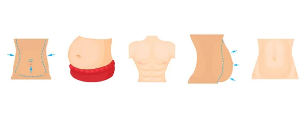 Abdomen Icon Set, Cartoon-Stil — Stockvektor