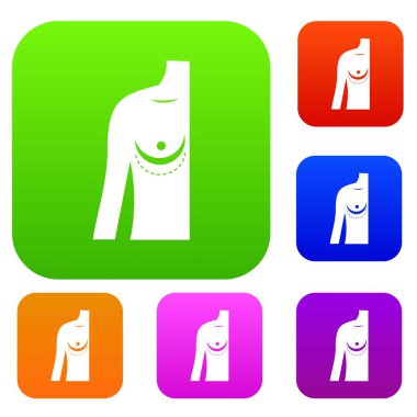 Meme implant ameliyatı. set renk koleksiyonu