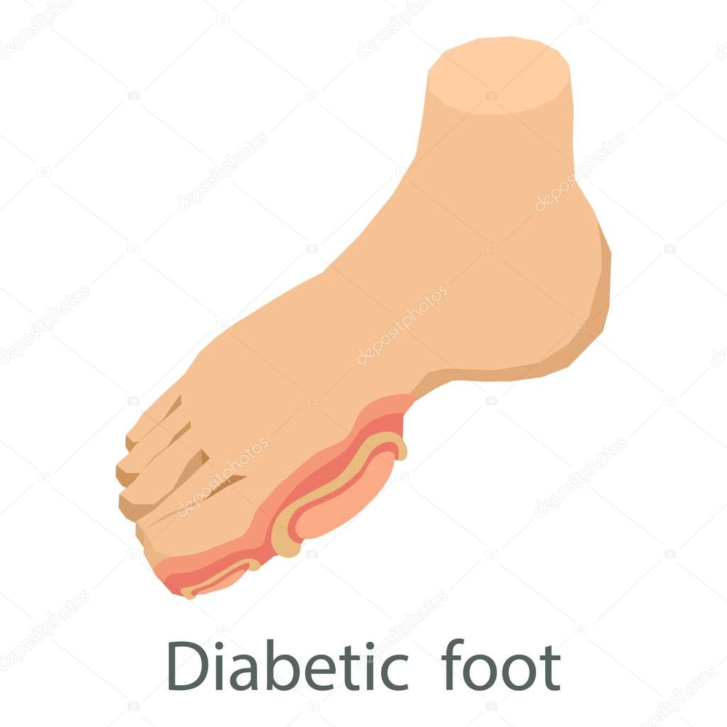 Diabetic foot icon. Isometric illustration of diabetic foot vector icon for web