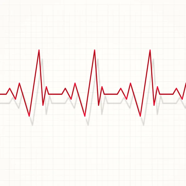 Kalp nabız kardiyogram — Stok fotoğraf