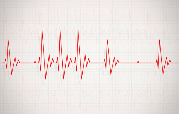 Irregular Heartbeat Illustration