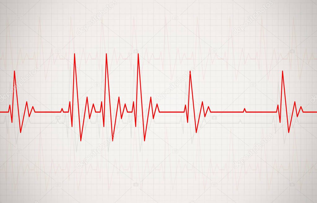 Irregular Heartbeat Illustration