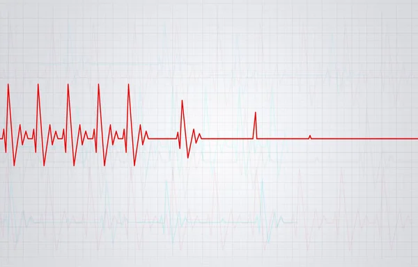 心臓が止まると脈動の図 — ストック写真