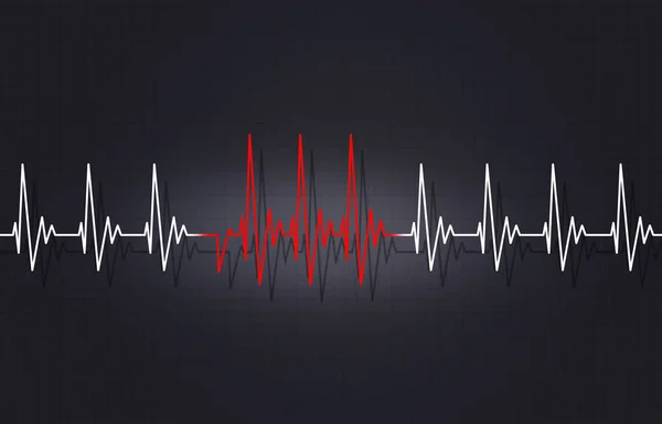 Nepravidelné arytmie srdce ilustrace — Stock fotografie