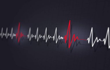 Kalp hastalığı Arrythmia