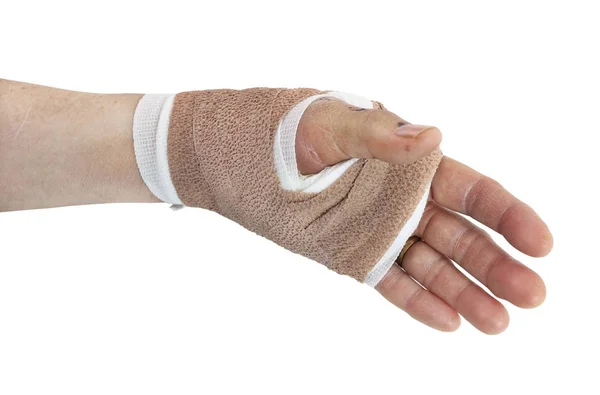 Бандаж Женской Руки Медицинской Клинике — стоковое фото
