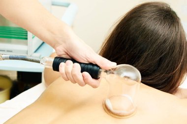 Tıbbi prosedür. Vakum masaj. Profesyonel doktor. Kız pat