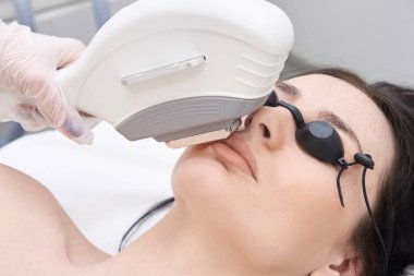 Yüz epilasyon. Parlak cilt. Tıbbi prosedür. Lazer 