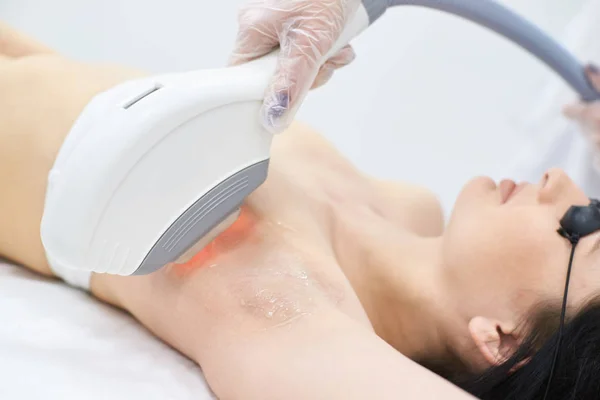 Depilación láser. Procedimiento médico. Quitando el pelo de la axila. B) — Foto de Stock